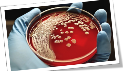 Nieuwsbericht: Pilot cursus voor contactpersonen InfectiePreventie (CIP)